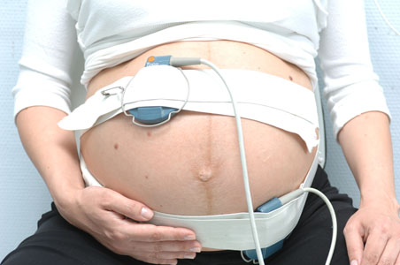 CTG (kardiotokográfia)