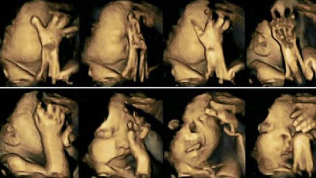 Ultrahangfelvételek készültek a dohányzó anyák magzatairól