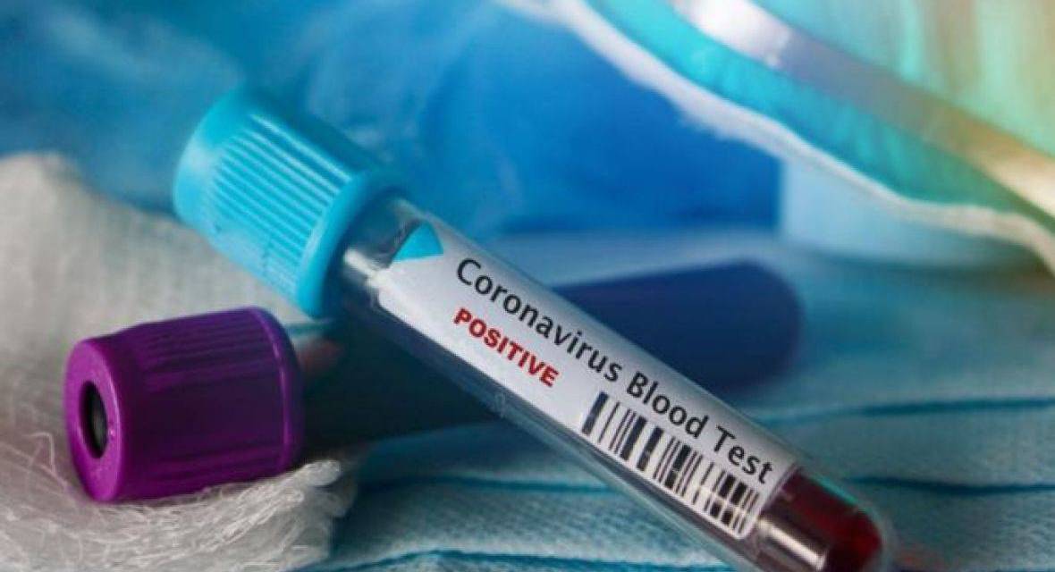 Ingyenes tesztelési lehetőség a határon túlról érkező diákoknak