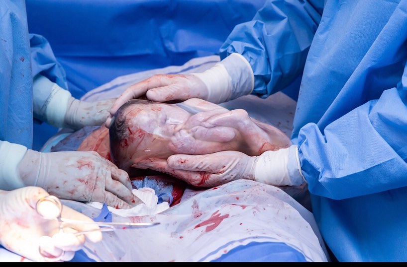 Hét percen át aludt, mintha még az édesanyja hasában lenne, a burokban született baba (Videóval)