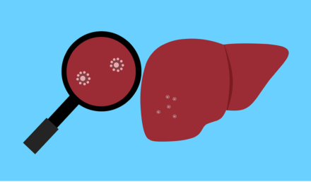 Új típusú hepatitisszel kezelnek egy belgrádi gyermeket