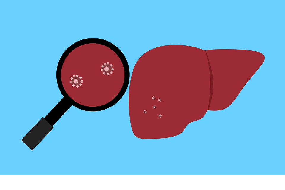 Új típusú hepatitisszel kezelnek egy belgrádi gyermeket